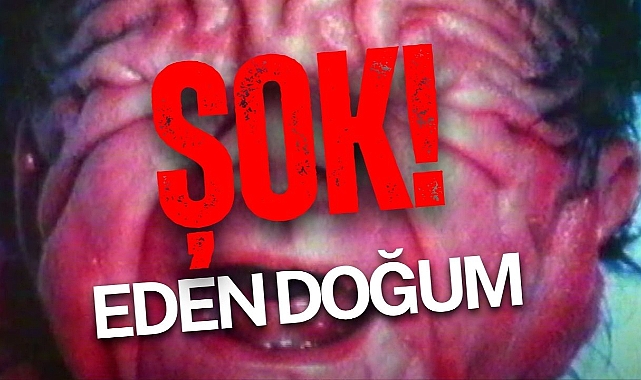 şok eden doğum!