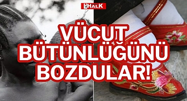 VÜCUT BÜTÜNLÜĞÜNÜ BOZDULAR!
