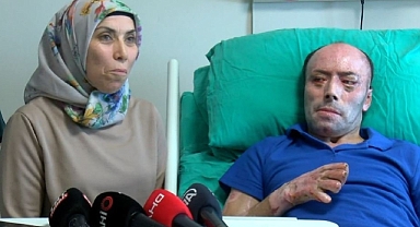Yaralı madenci 140 ameliyat ve 8 aylık tedavinin ardından taburcu edildi