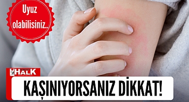 Kaşınıyorsanız dikkat!