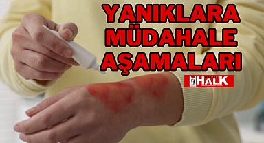 YANIKLARA MÜDAHALE AŞAMALARI
