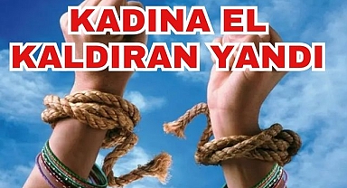 Kadına El Kaldıran Yandı