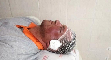 Belediye İşçisine Saldırı